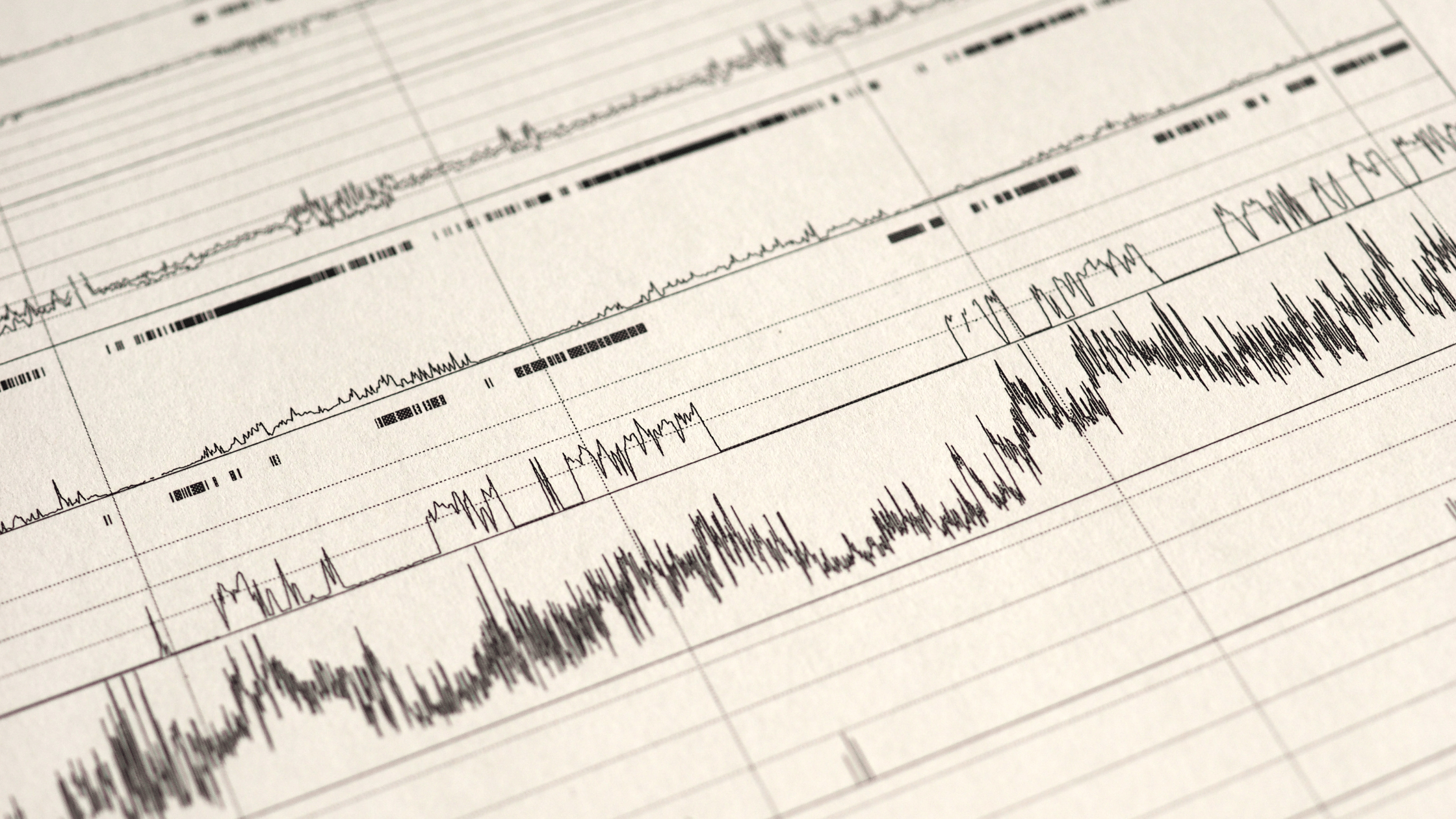 Picture of Understanding Apnea-Hypopnea Index (AHI)